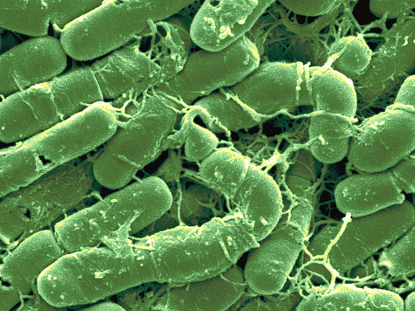 Bacillus-thuringiensis-History.jpg